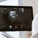 Затлъстяване и гинекологични проблеми obesity gyno
